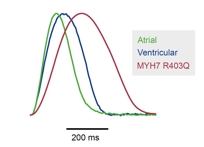 Atrial-Ventricular